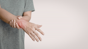 Rot markierte Handgelenk-Entzündung als Beispiel für Cortisol-bedingte Beschwerden